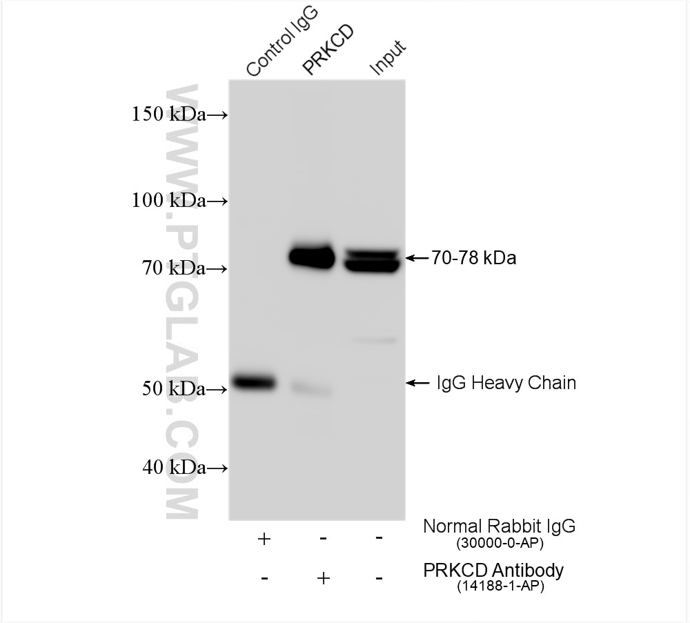 Immunoprecipitation (IP) experiment of mouse brain tissue using PKC Delta Polyclonal antibody (14188-1-AP)
