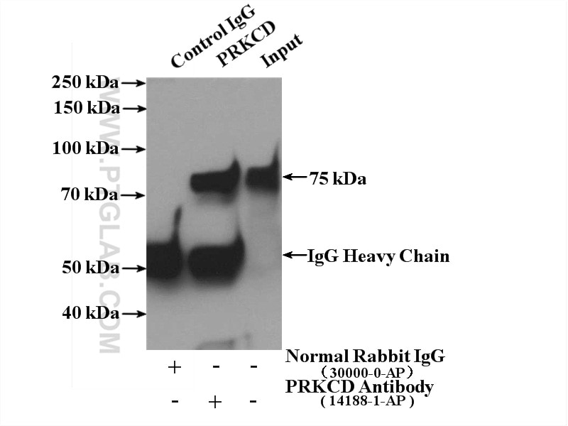 Immunoprecipitation (IP) experiment of mouse brain tissue using PKC Delta Polyclonal antibody (14188-1-AP)