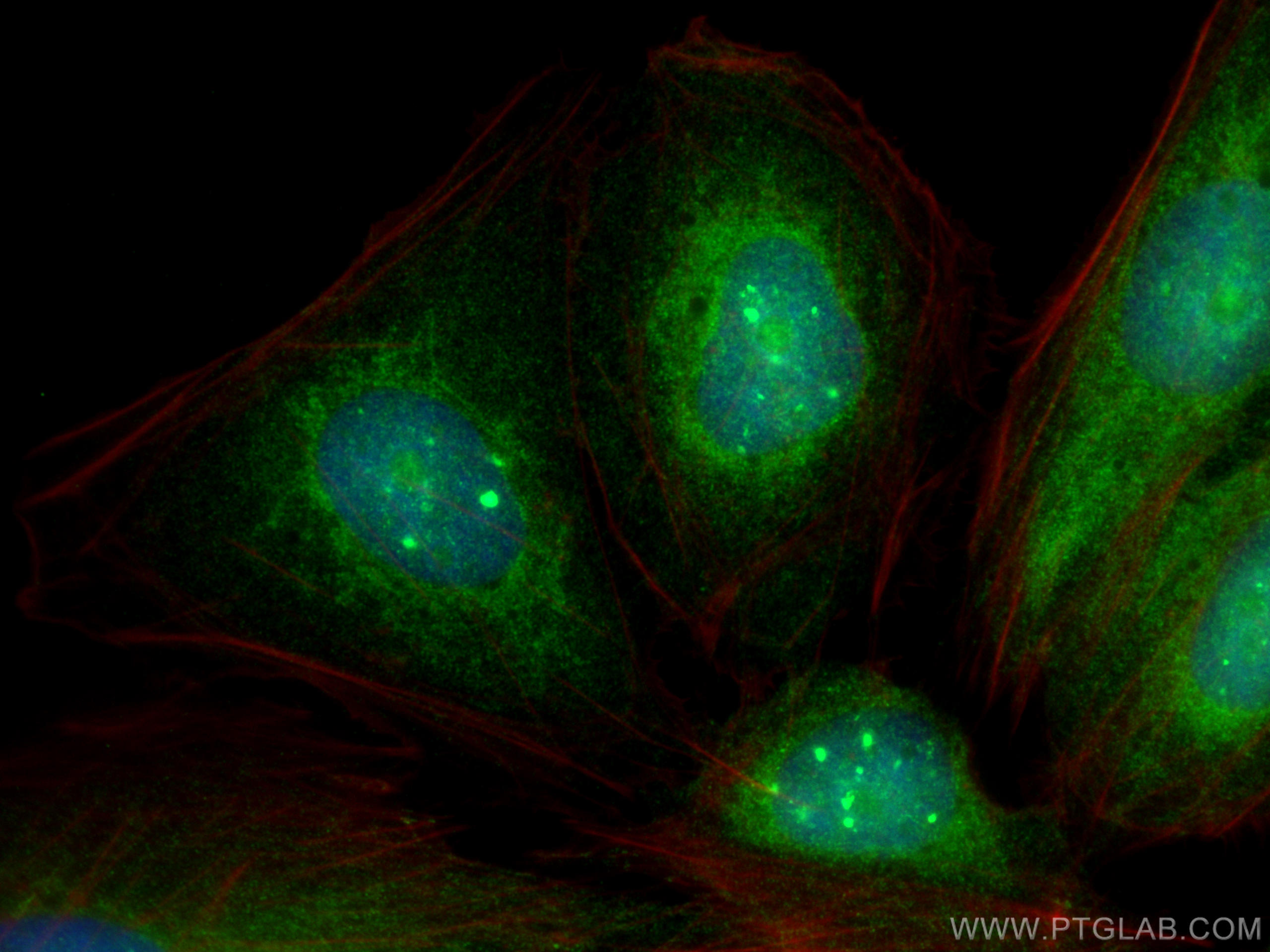 Immunofluorescence (IF) / fluorescent staining of U2OS cells using PKC Delta Polyclonal antibody (19132-1-AP)
