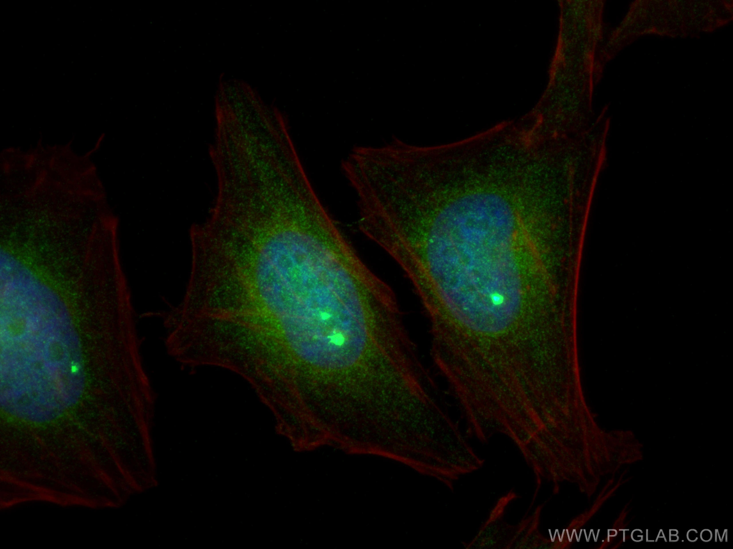 Immunofluorescence (IF) / fluorescent staining of HeLa cells using PKC Delta Polyclonal antibody (19132-1-AP)