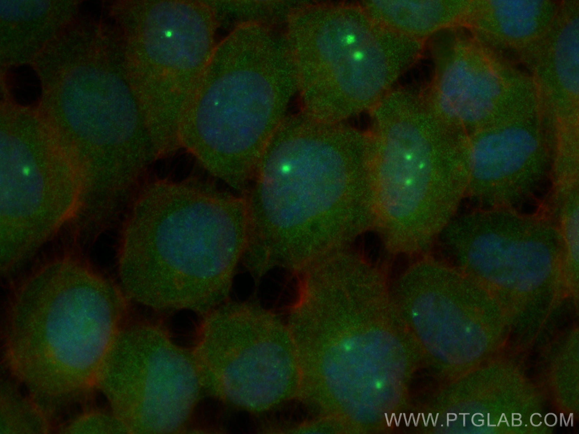 Immunofluorescence (IF) / fluorescent staining of A431 cells using PKC Delta Polyclonal antibody (19132-1-AP)