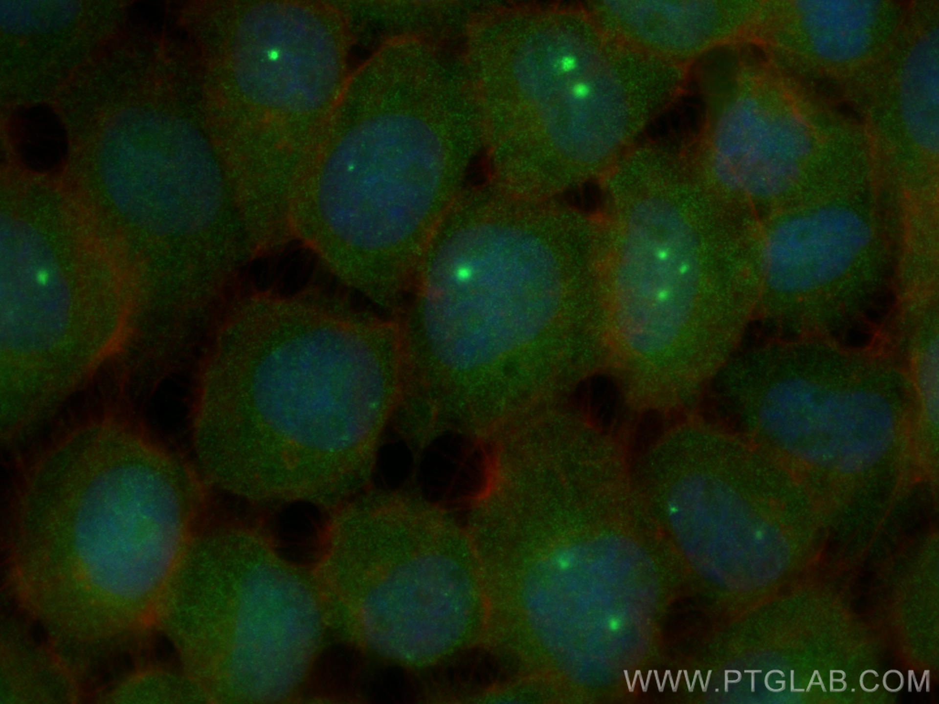 IF Staining of A431 using 19132-1-AP