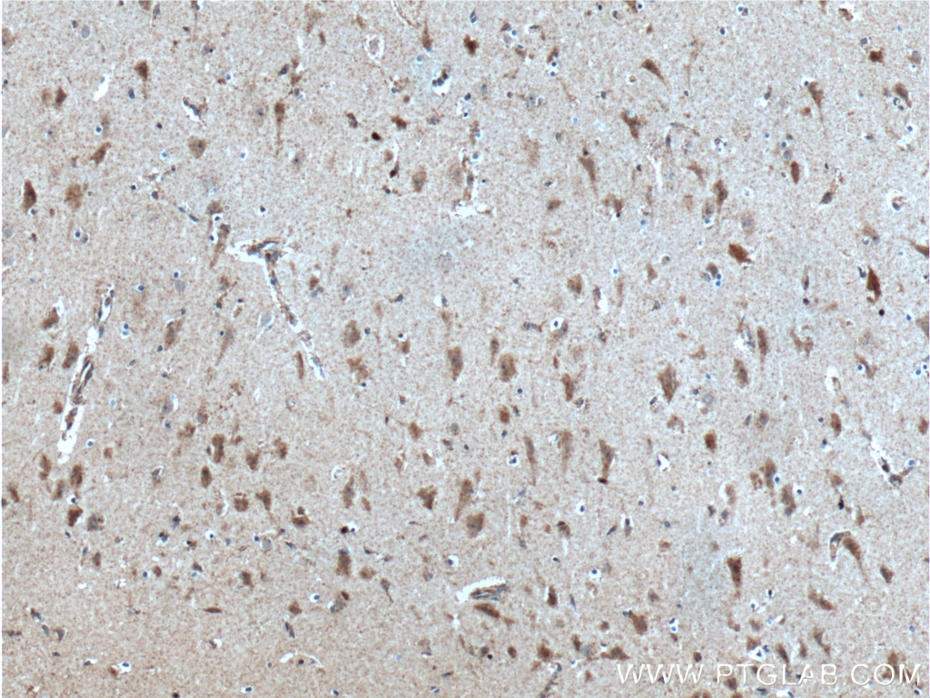 Immunohistochemistry (IHC) staining of human brain tissue using PKC Delta Polyclonal antibody (19132-1-AP)