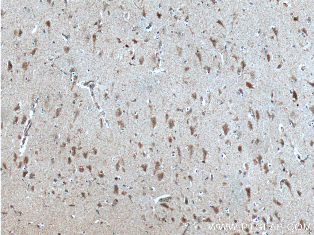 IHC staining of human brain using 19132-1-AP