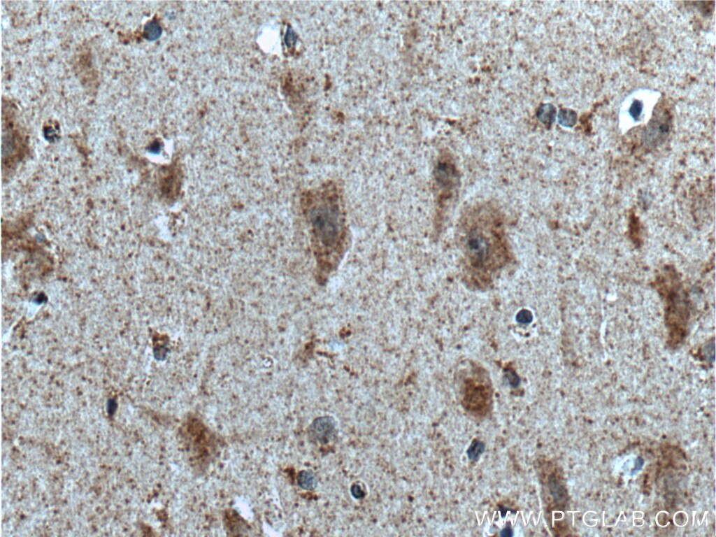 Immunohistochemistry (IHC) staining of human brain tissue using PKC Delta Polyclonal antibody (19132-1-AP)