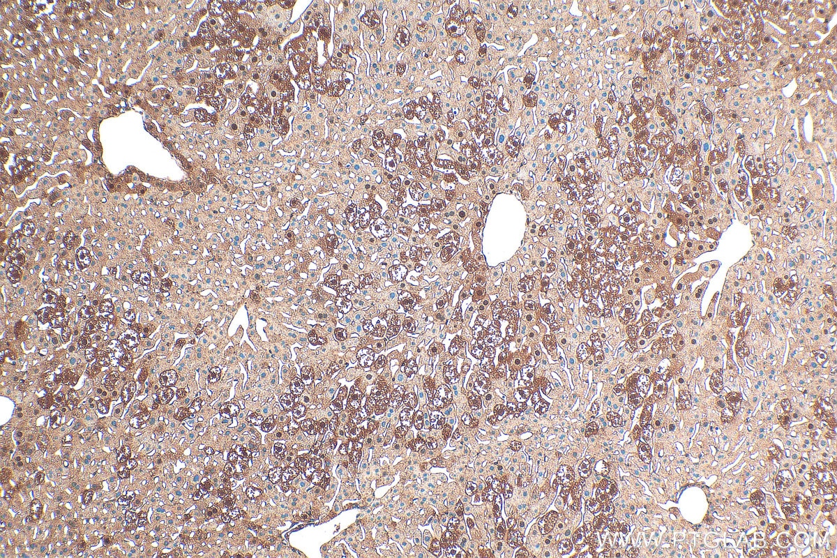 Immunohistochemistry (IHC) staining of mouse liver tissue using PKC Delta Polyclonal antibody (19132-1-AP)