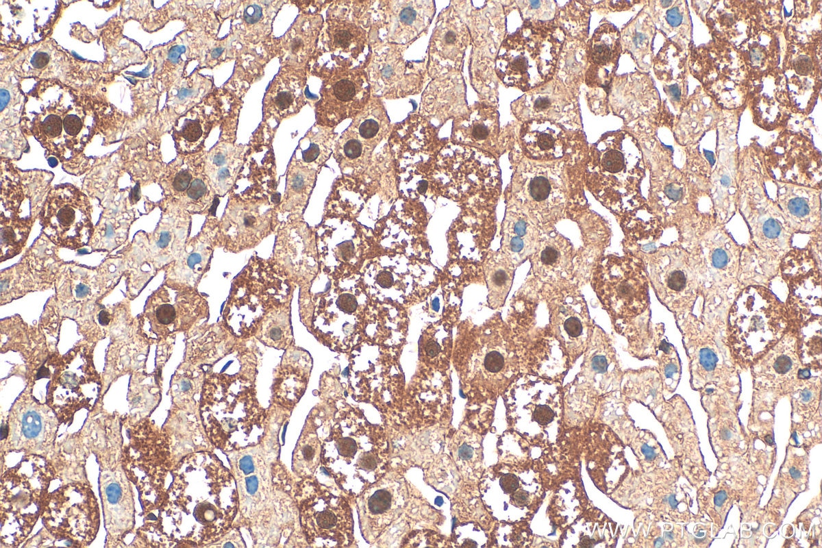Immunohistochemistry (IHC) staining of mouse liver tissue using PKC Delta Polyclonal antibody (19132-1-AP)