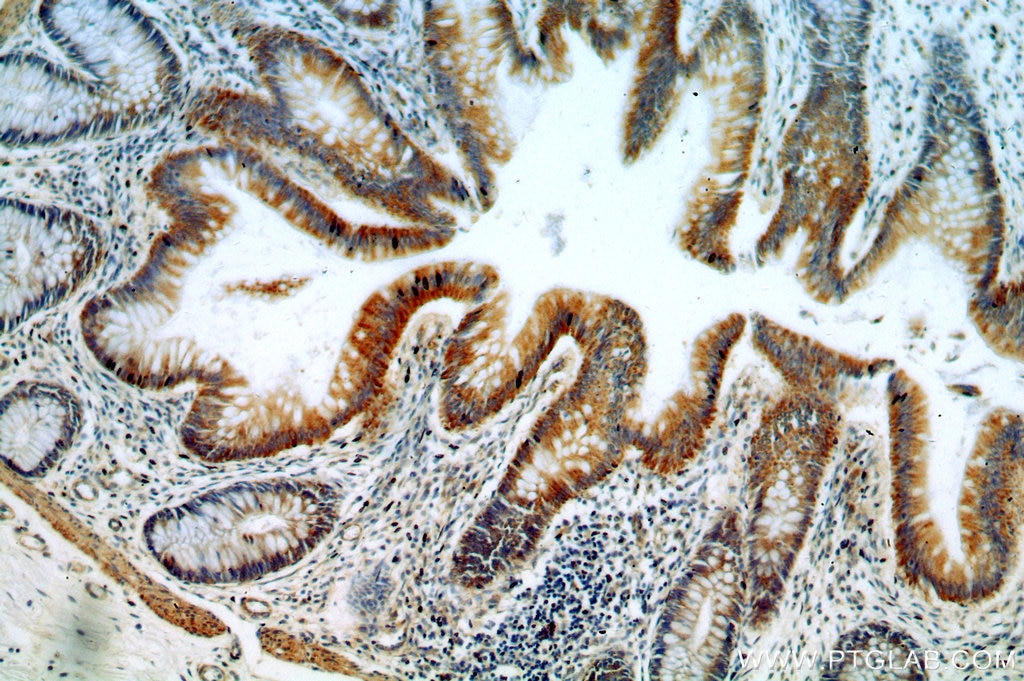 Immunohistochemistry (IHC) staining of human colon tissue using PKC Delta Polyclonal antibody (19132-1-AP)