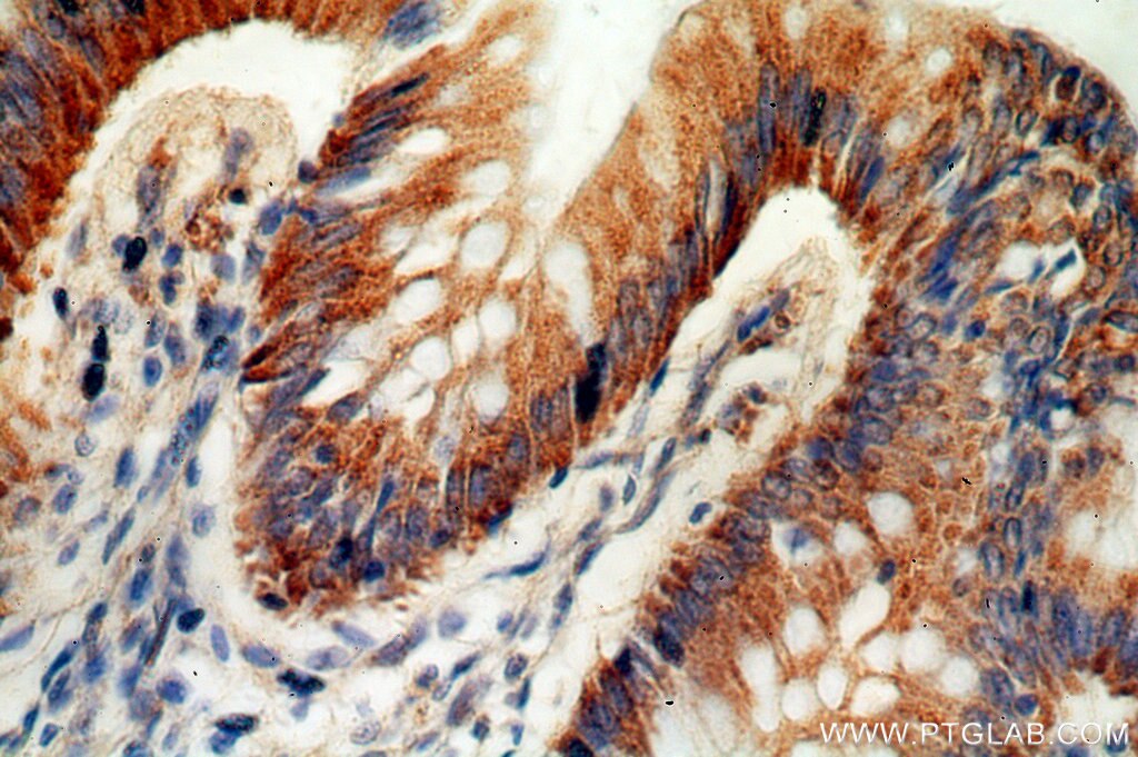 IHC staining of human colon using 19132-1-AP