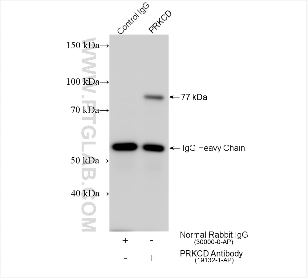Immunoprecipitation (IP) experiment of A431 cells using PKC Delta Polyclonal antibody (19132-1-AP)