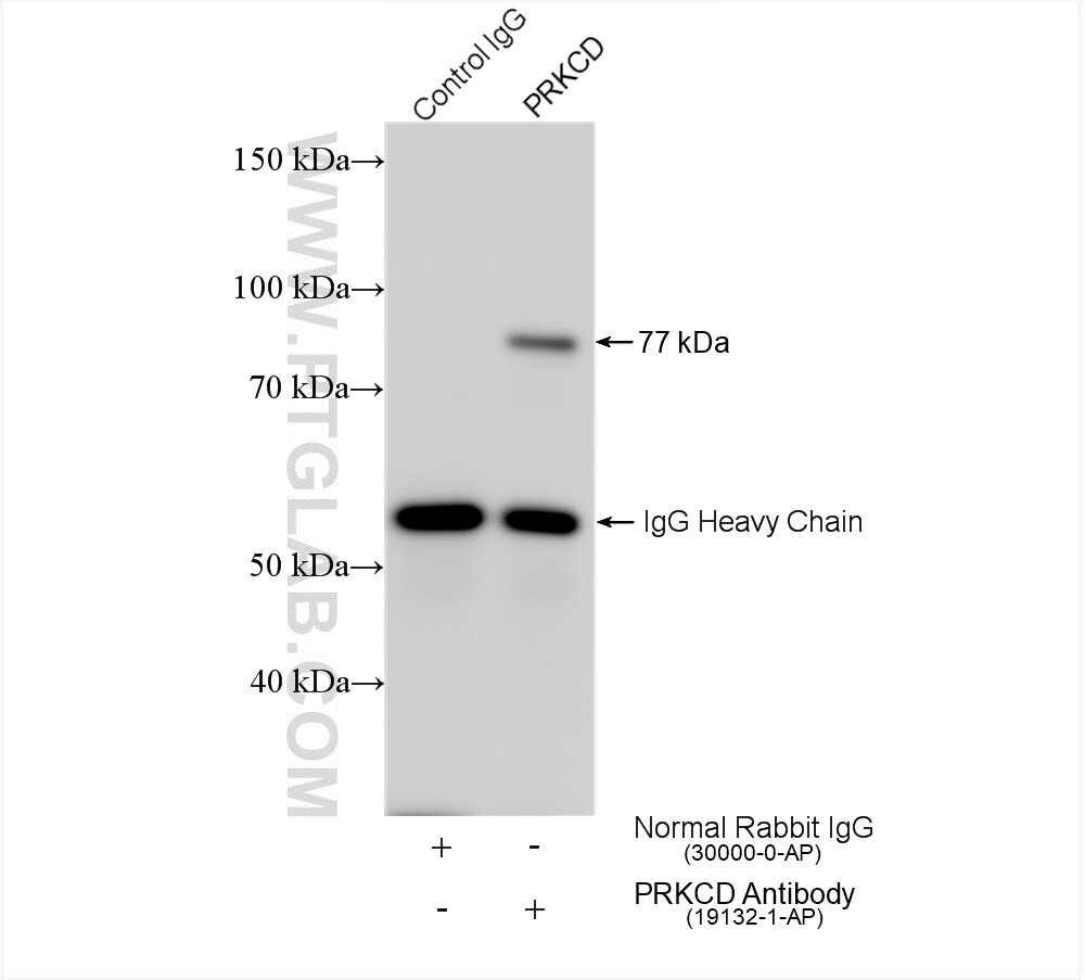 IP experiment of A431 using 19132-1-AP