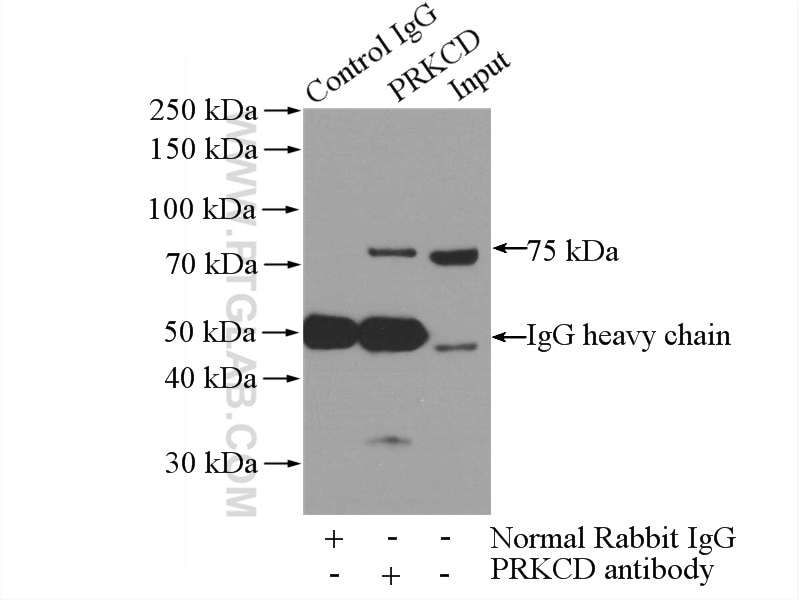 Immunoprecipitation (IP) experiment of A431 cells using PKC Delta Polyclonal antibody (19132-1-AP)