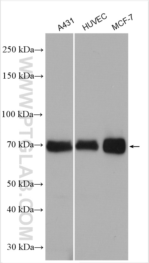 Western Blot (WB) analysis of various lysates using PKC Delta Polyclonal antibody (19132-1-AP)