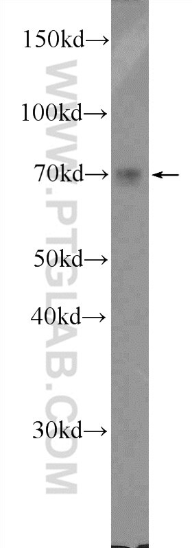 WB analysis of mouse colon using 19132-1-AP