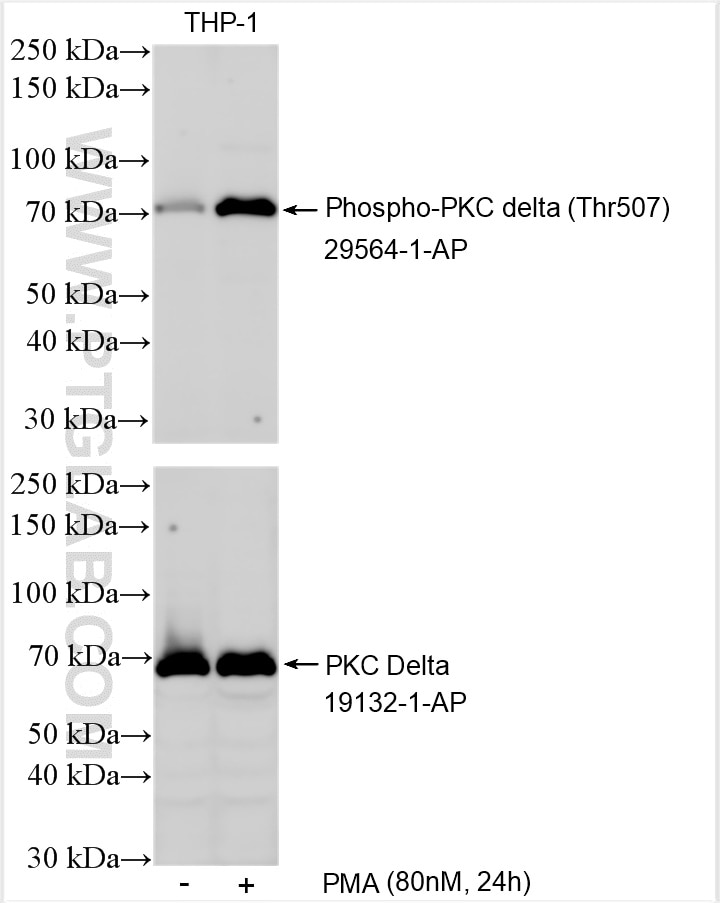 Western Blot (WB) analysis of various lysates using PKC Delta Polyclonal antibody (19132-1-AP)