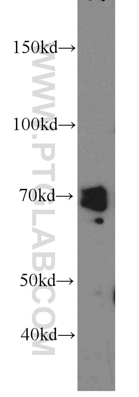 Western Blot (WB) analysis of Jurkat cells using PKC Delta Polyclonal antibody (19132-1-AP)