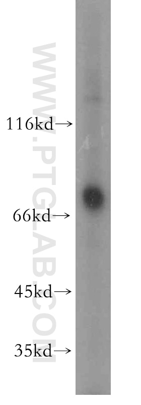 Western Blot (WB) analysis of MCF-7 cells using PKC Delta Polyclonal antibody (19132-1-AP)
