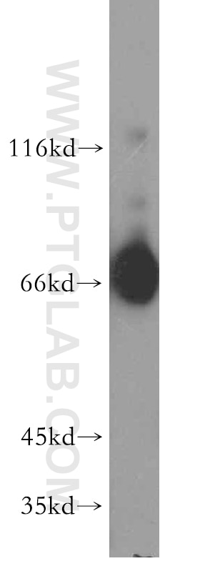 Western Blot (WB) analysis of HT-1080 cells using PKC Delta Polyclonal antibody (19132-1-AP)