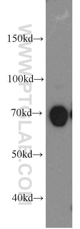 WB analysis of A431 using 19132-1-AP