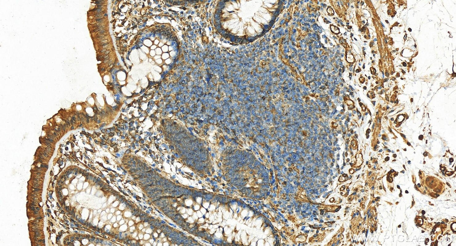 Immunohistochemistry (IHC) staining of human normal colon using PRKCDBP Polyclonal antibody (16250-1-AP)