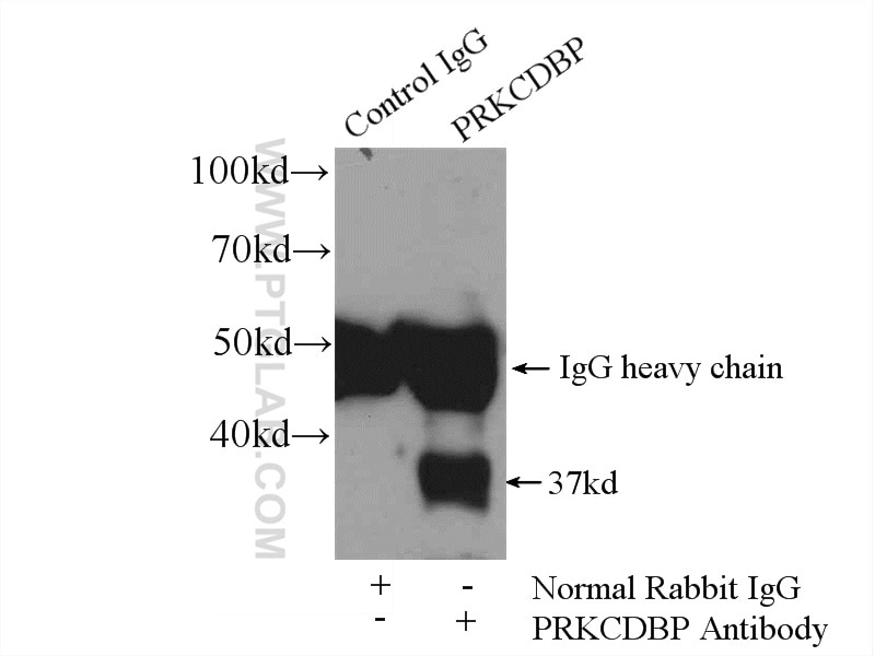 Immunoprecipitation (IP) experiment of mouse lung tissue using PRKCDBP Polyclonal antibody (16250-1-AP)