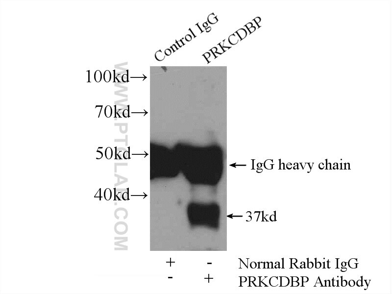 Immunoprecipitation (IP) experiment of mouse lung tissue using PRKCDBP Polyclonal antibody (16250-1-AP)