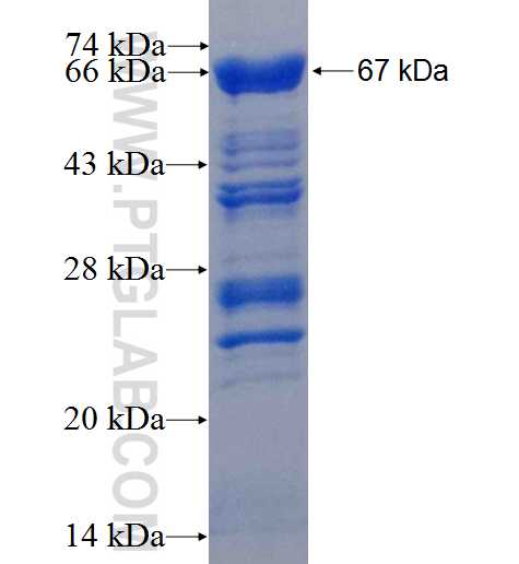 PRKCDBP fusion protein Ag9209 SDS-PAGE