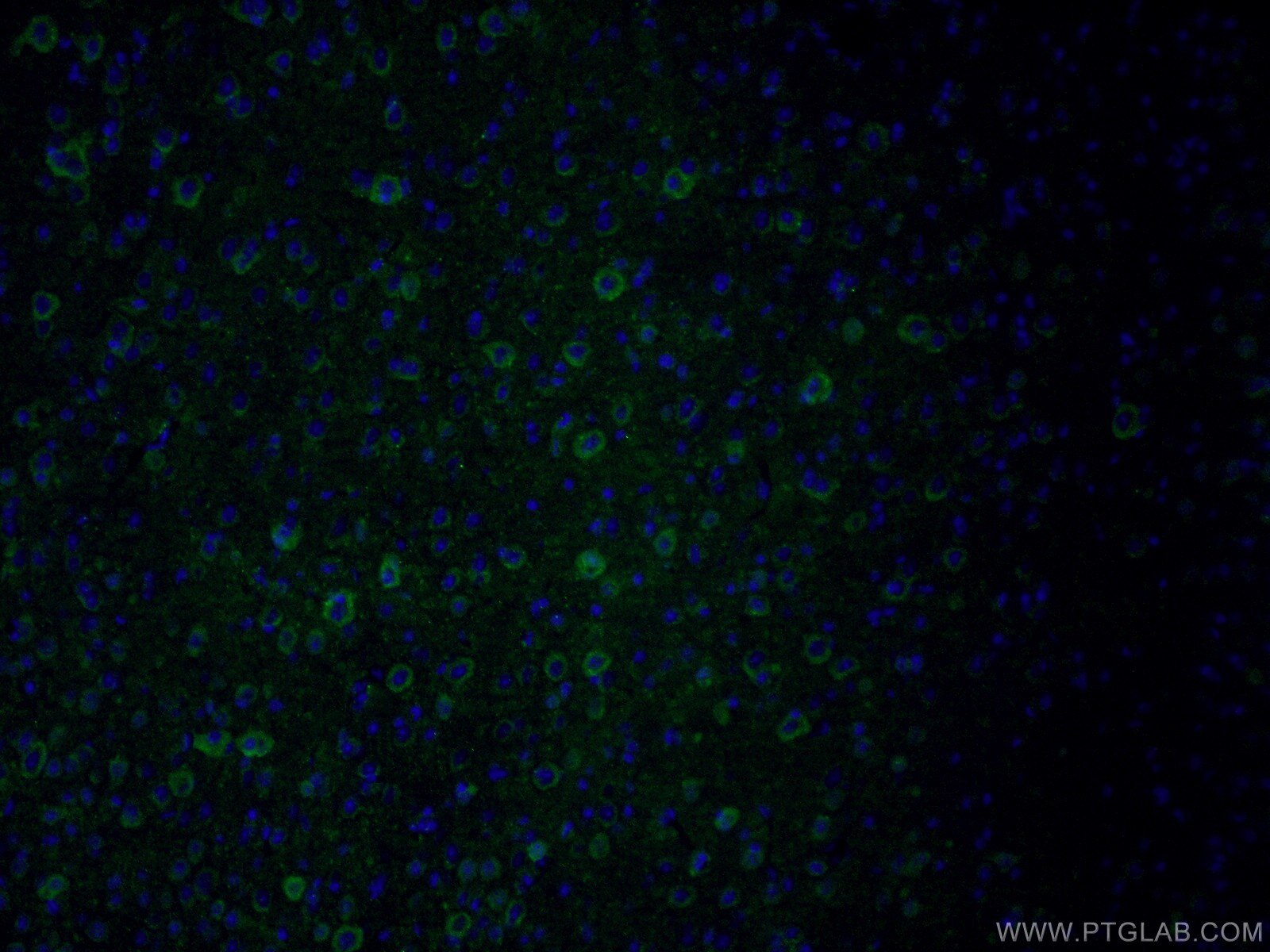 Immunofluorescence (IF) / fluorescent staining of mouse brain tissue using PKC Epsilon Polyclonal antibody (20877-1-AP)