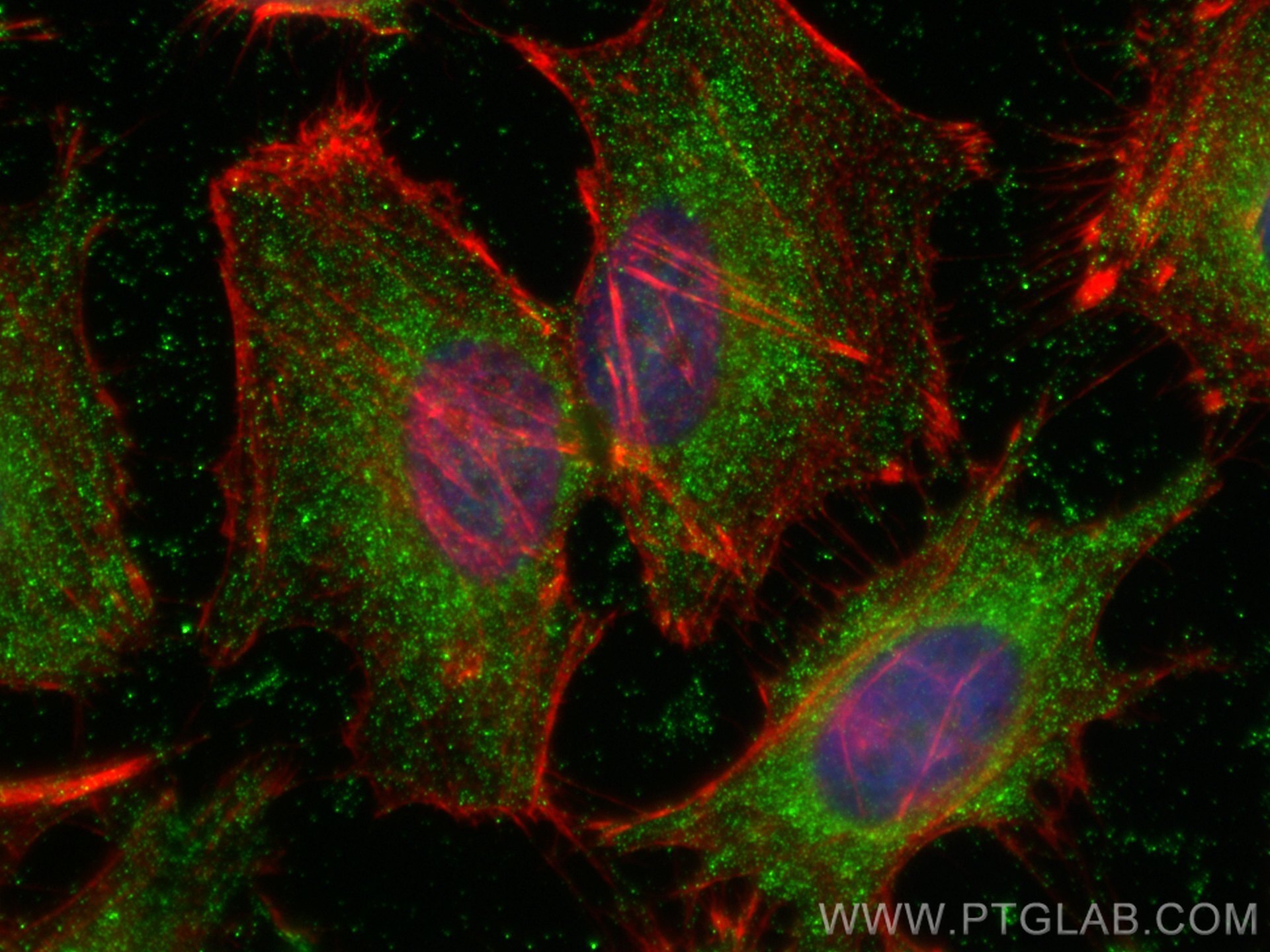 Immunofluorescence (IF) / fluorescent staining of HeLa cells using PKC Epsilon Polyclonal antibody (20877-1-AP)