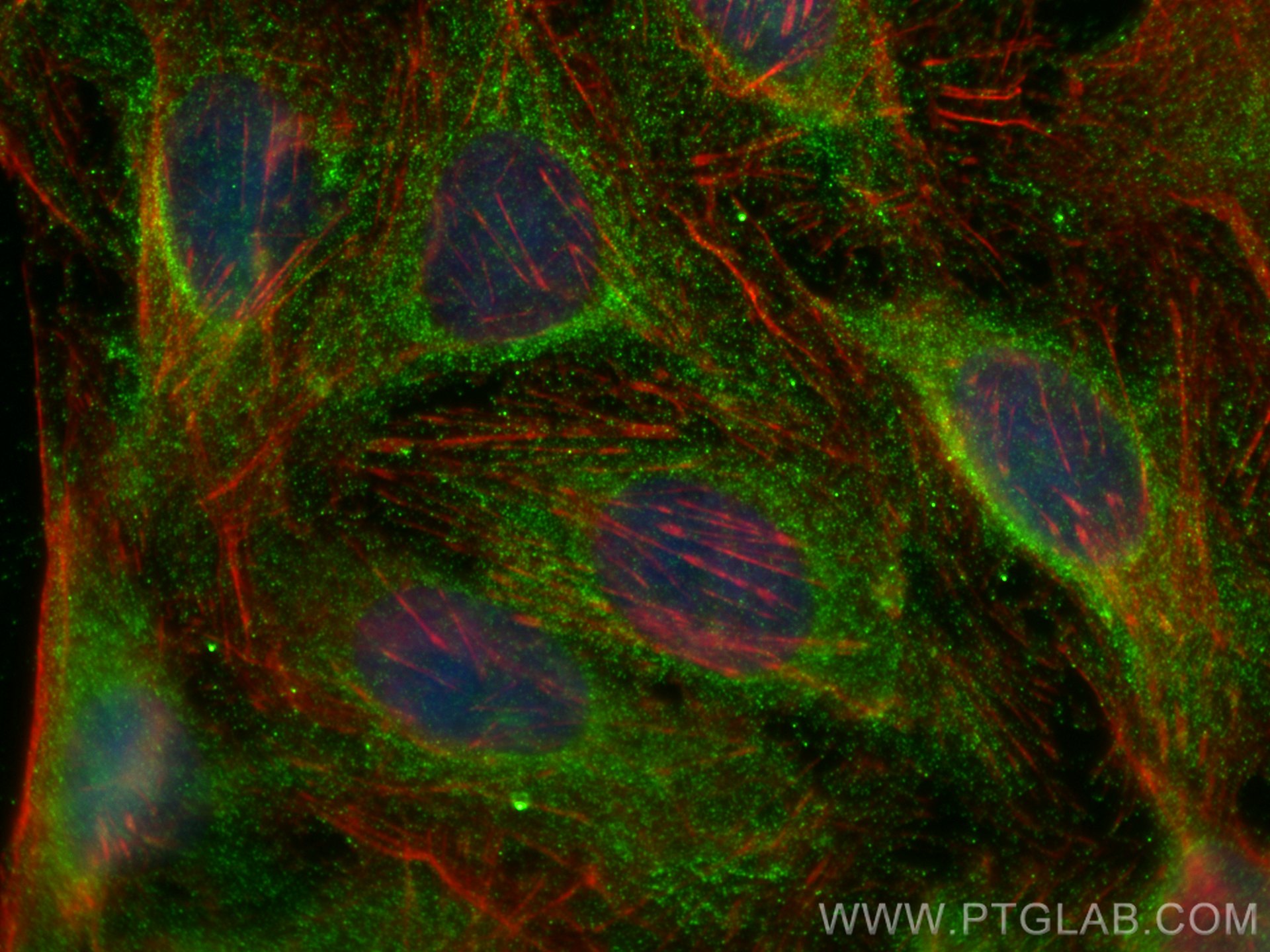 Immunofluorescence (IF) / fluorescent staining of U2OS cells using PKC Epsilon Polyclonal antibody (20877-1-AP)
