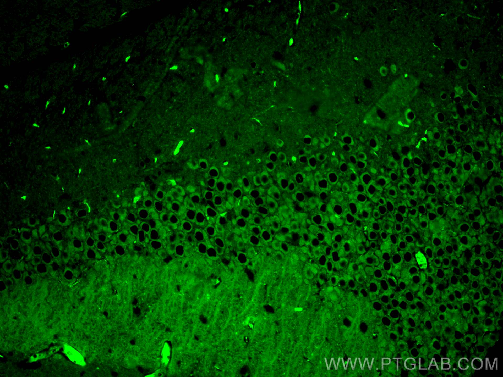 Immunofluorescence (IF) / fluorescent staining of mouse brain tissue using PKC Epsilon Polyclonal antibody (20877-1-AP)