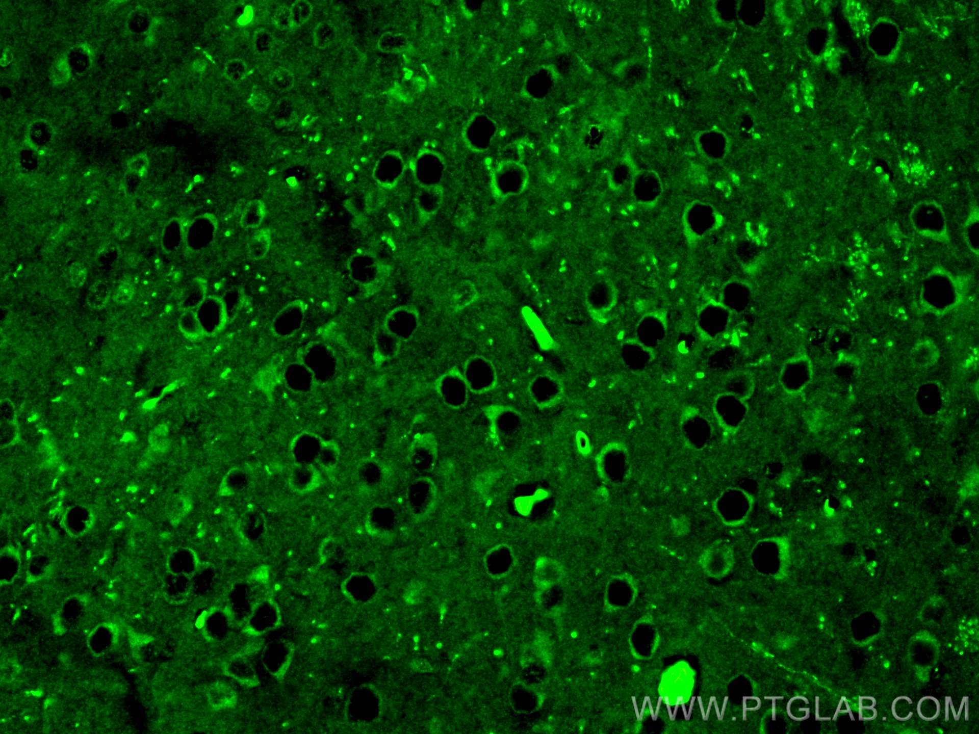 Immunofluorescence (IF) / fluorescent staining of mouse brain tissue using PKC Epsilon Polyclonal antibody (20877-1-AP)