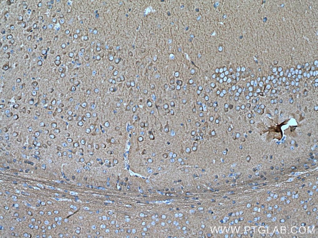 Immunohistochemistry (IHC) staining of mouse brain tissue using PKC Epsilon Polyclonal antibody (20877-1-AP)