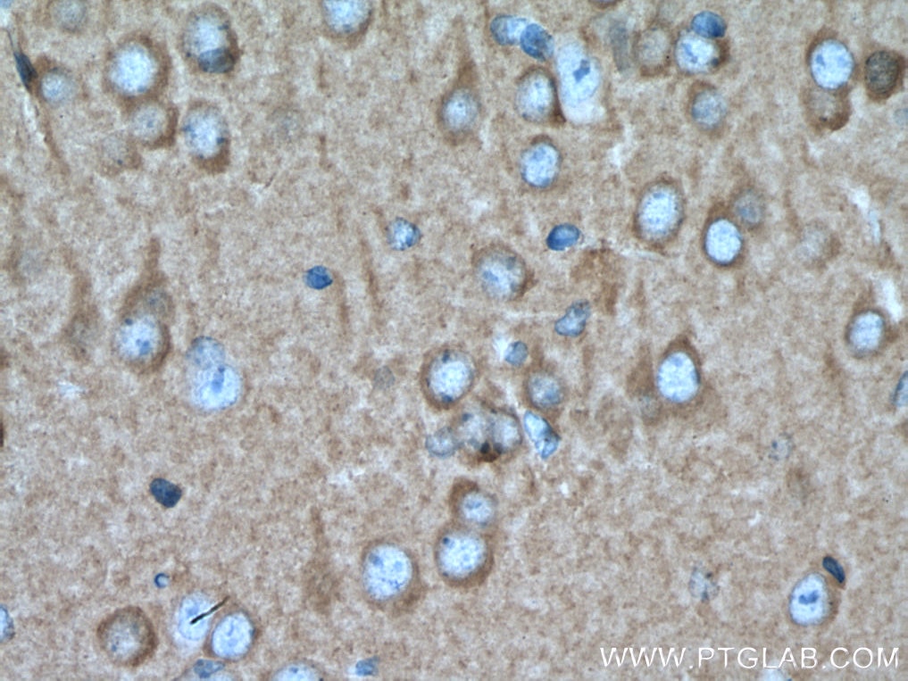Immunohistochemistry (IHC) staining of mouse brain tissue using PKC Epsilon Polyclonal antibody (20877-1-AP)