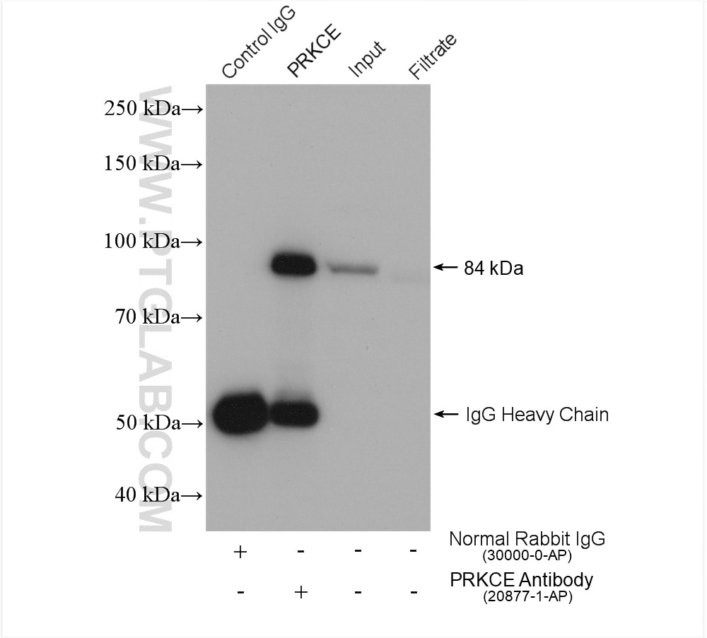 Immunoprecipitation (IP) experiment of SH-SY5Y cells using PKC Epsilon Polyclonal antibody (20877-1-AP)