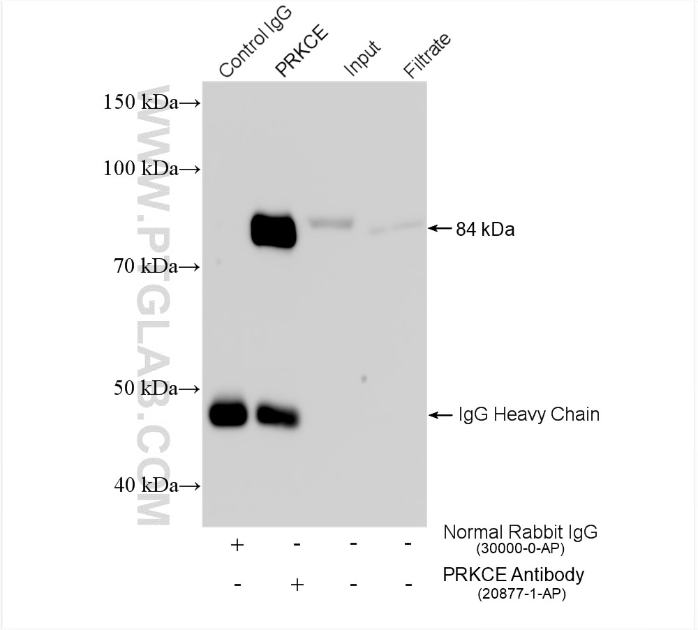 Immunoprecipitation (IP) experiment of SH-SY5Y cells using PKC Epsilon Polyclonal antibody (20877-1-AP)