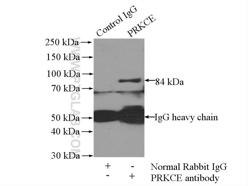 Immunoprecipitation (IP) experiment of SH-SY5Y cells using PKC Epsilon Polyclonal antibody (20877-1-AP)
