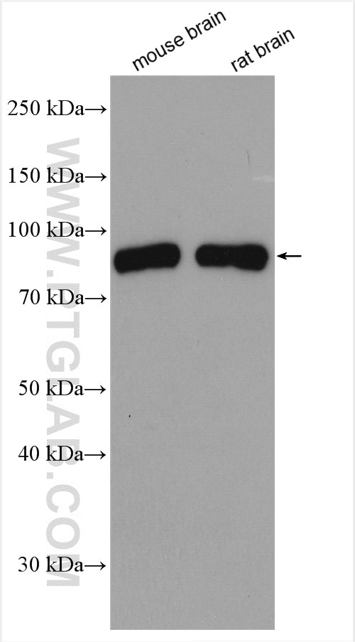 Western Blot (WB) analysis of various lysates using PKC Epsilon Polyclonal antibody (20877-1-AP)