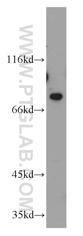 Western Blot (WB) analysis of SH-SY5Y cells using PKC Epsilon Polyclonal antibody (20877-1-AP)
