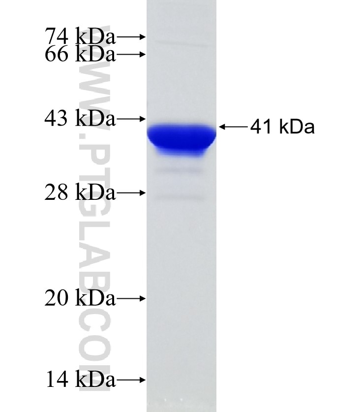 PRKCE fusion protein Ag14976 SDS-PAGE