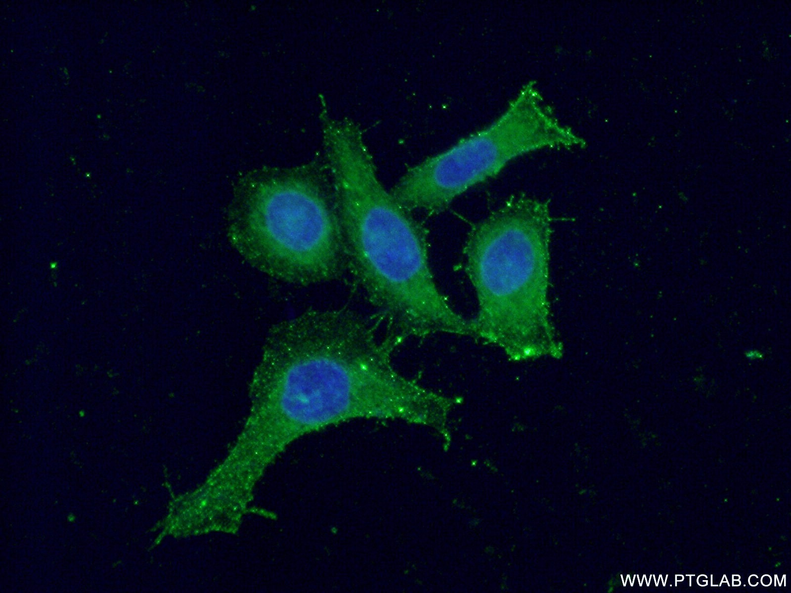 Immunofluorescence (IF) / fluorescent staining of HeLa cells using PKC Gamma Polyclonal antibody (14364-1-AP)