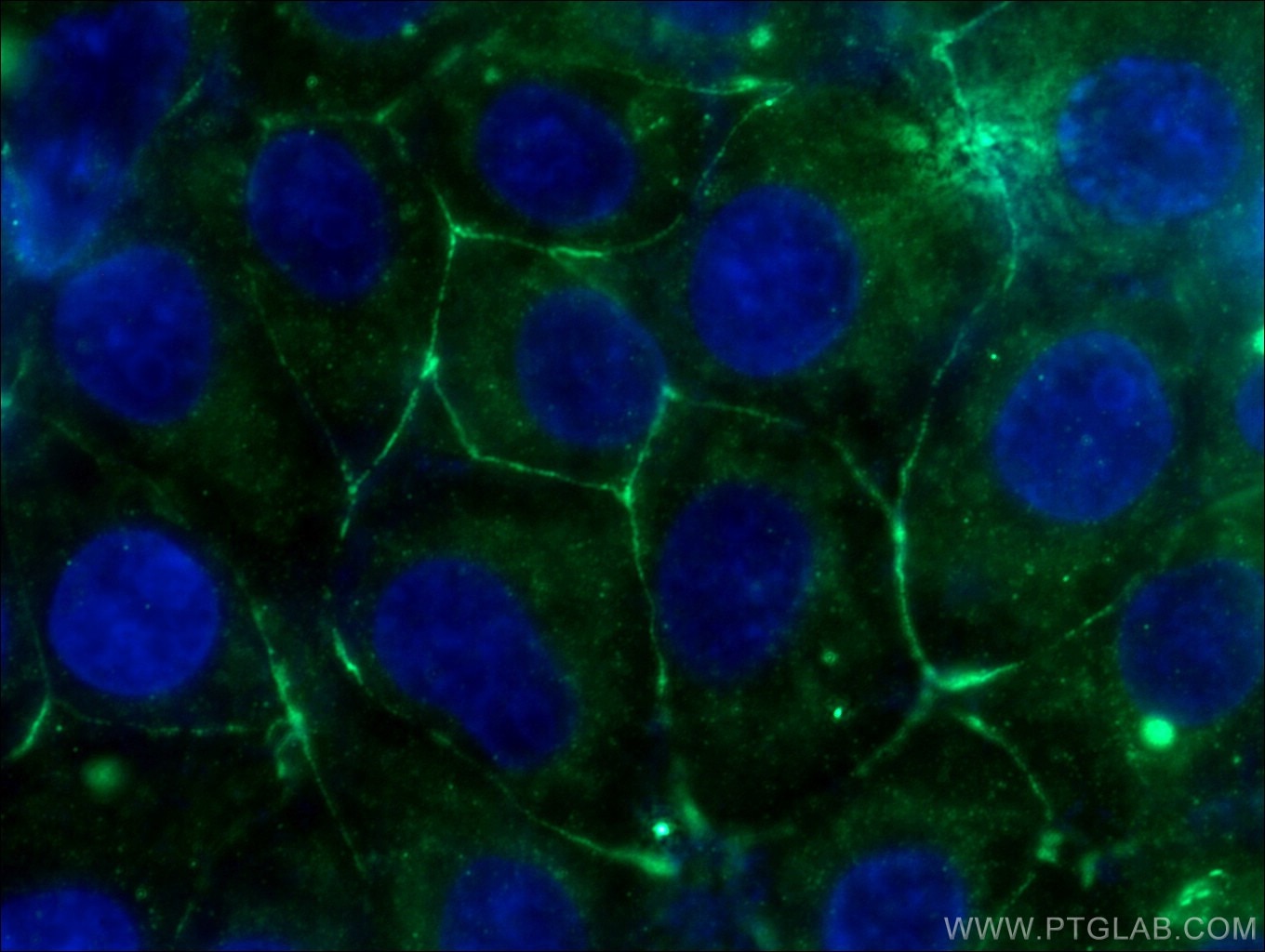 Immunofluorescence (IF) / fluorescent staining of SH-SY5Y cells using PKC Gamma Polyclonal antibody (14364-1-AP)