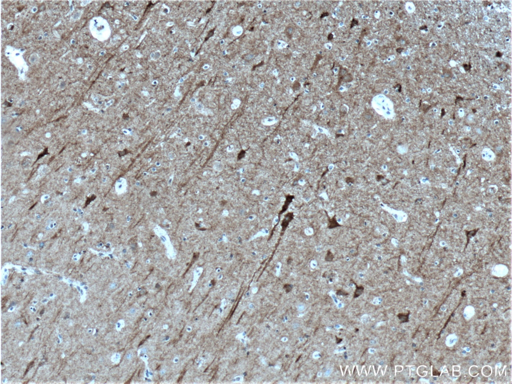Immunohistochemistry (IHC) staining of human brain tissue using PKC Gamma Polyclonal antibody (14364-1-AP)