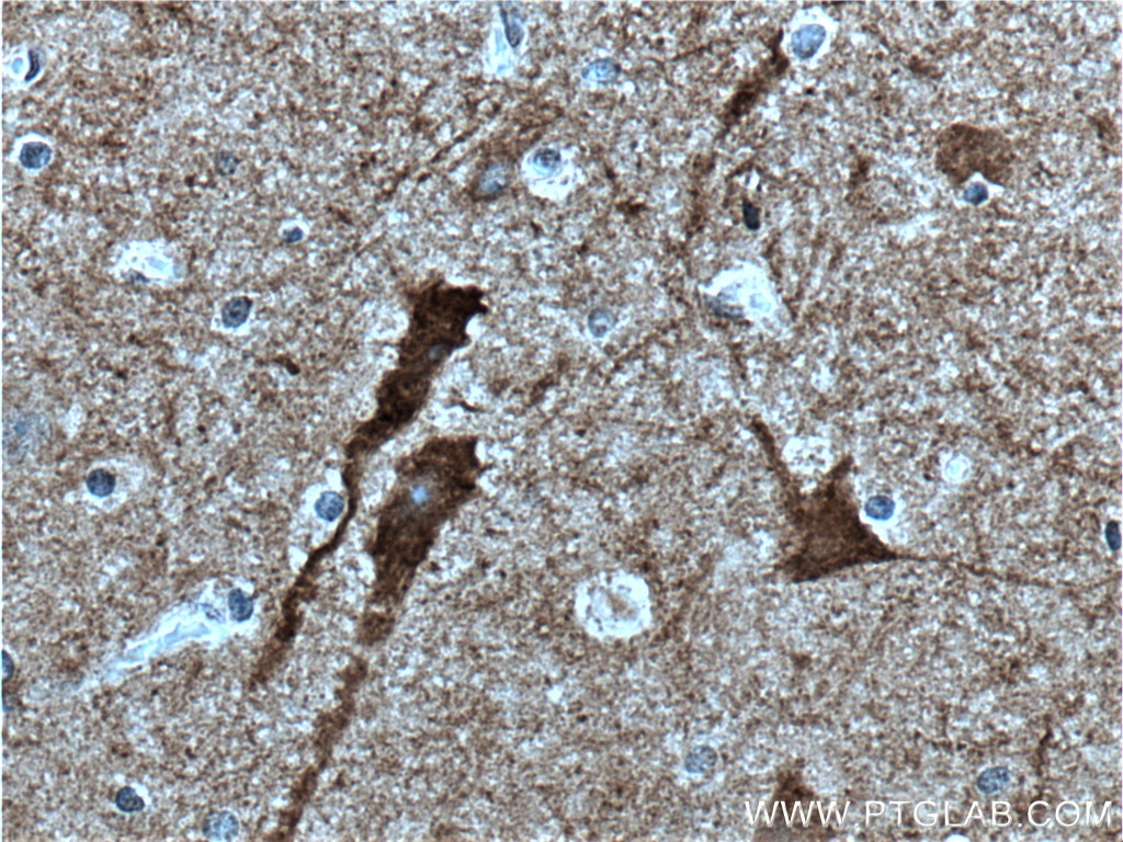 IHC staining of human brain using 14364-1-AP