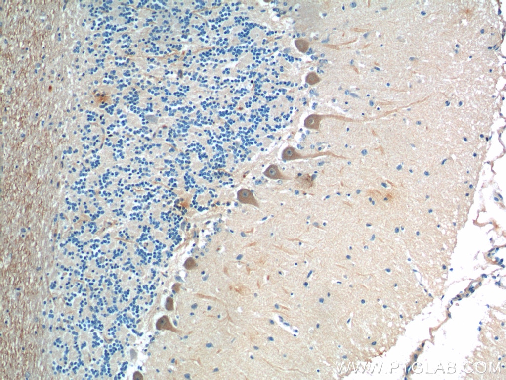 IHC staining of human cerebellum using 14364-1-AP