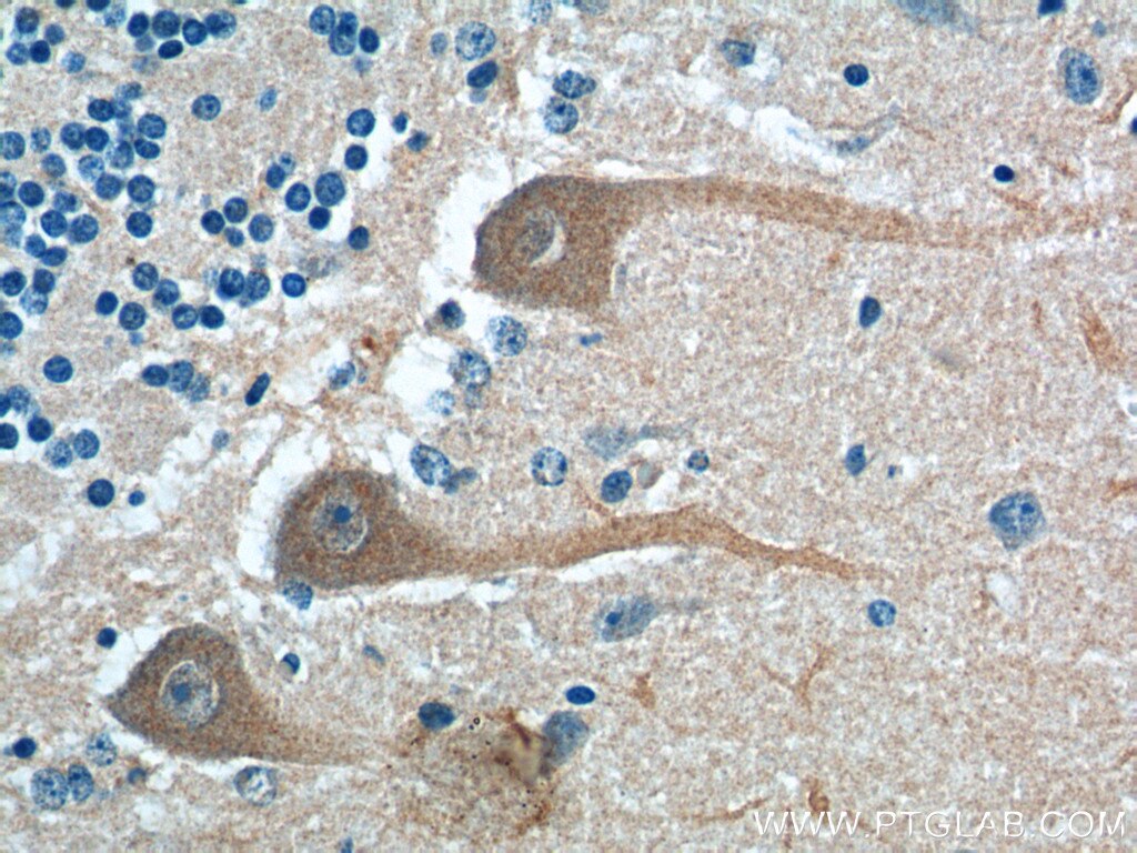 Immunohistochemistry (IHC) staining of human cerebellum tissue using PKC Gamma Polyclonal antibody (14364-1-AP)