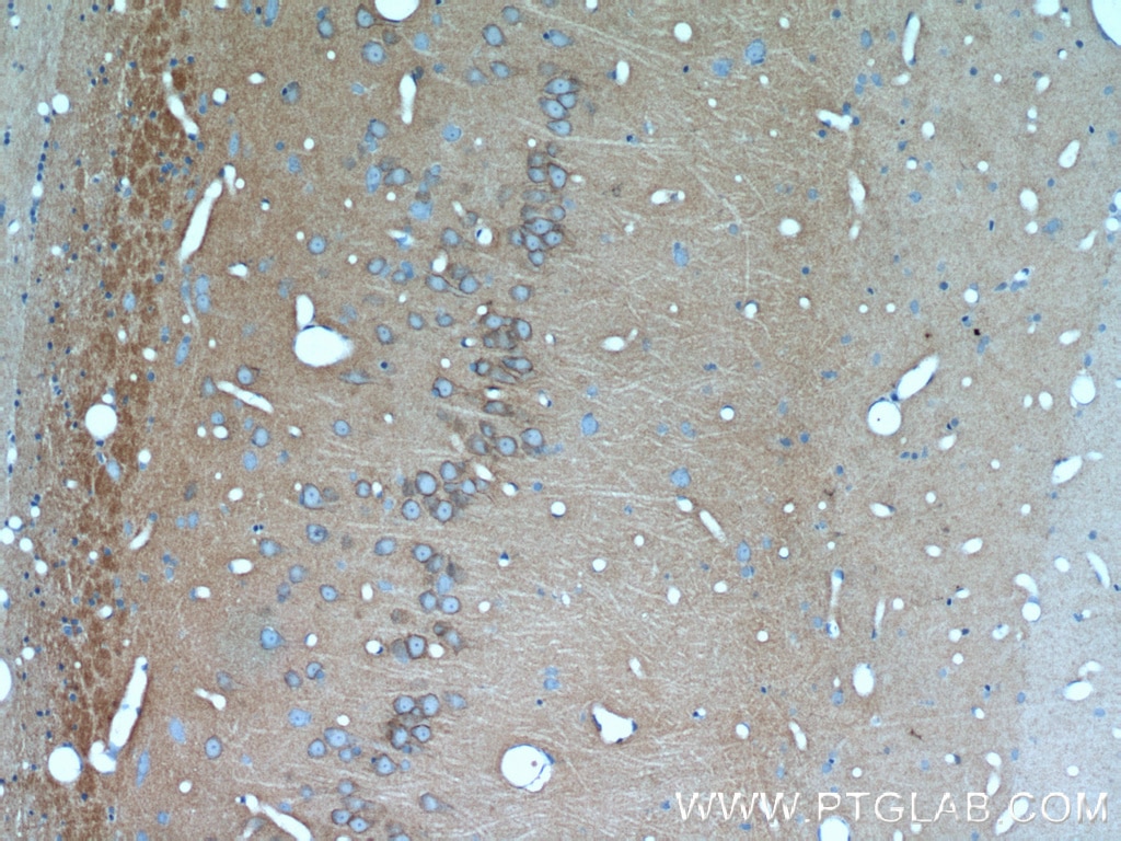 Immunohistochemistry (IHC) staining of rat brain tissue using PKC Gamma Polyclonal antibody (14364-1-AP)