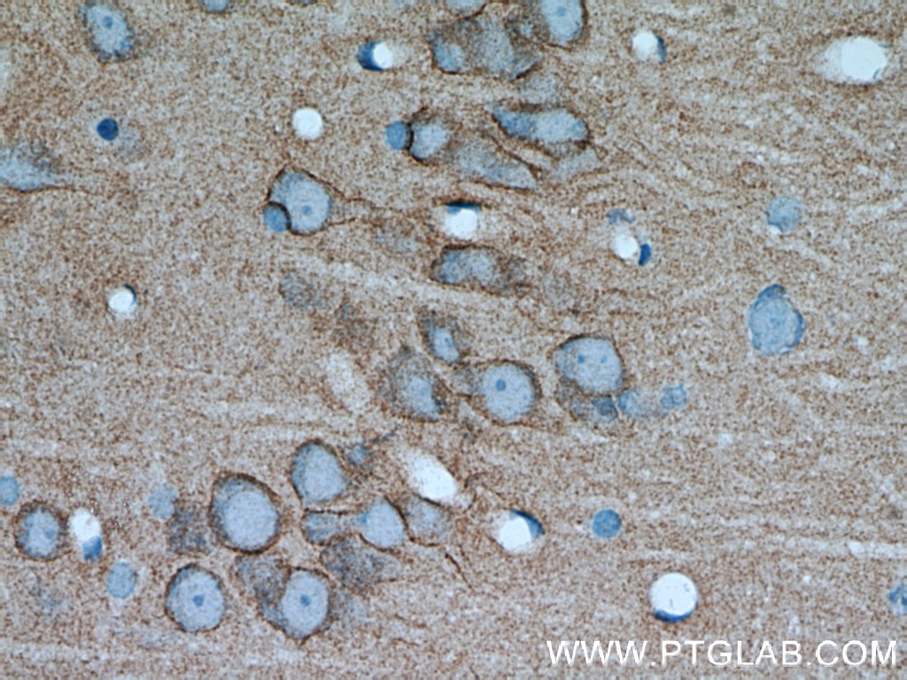 Immunohistochemistry (IHC) staining of rat brain tissue using PKC Gamma Polyclonal antibody (14364-1-AP)