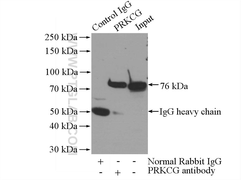 Immunoprecipitation (IP) experiment of mouse brain tissue using PKC Gamma Polyclonal antibody (14364-1-AP)