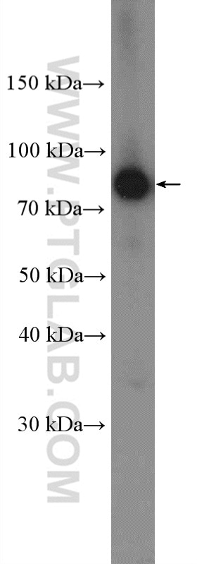 Western Blot (WB) analysis of mouse brain tissue using PKC Gamma Polyclonal antibody (14364-1-AP)